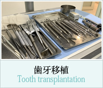 歯牙移植
